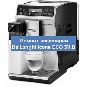 Замена счетчика воды (счетчика чашек, порций) на кофемашине De'Longhi Icona ECO 311.B в Санкт-Петербурге